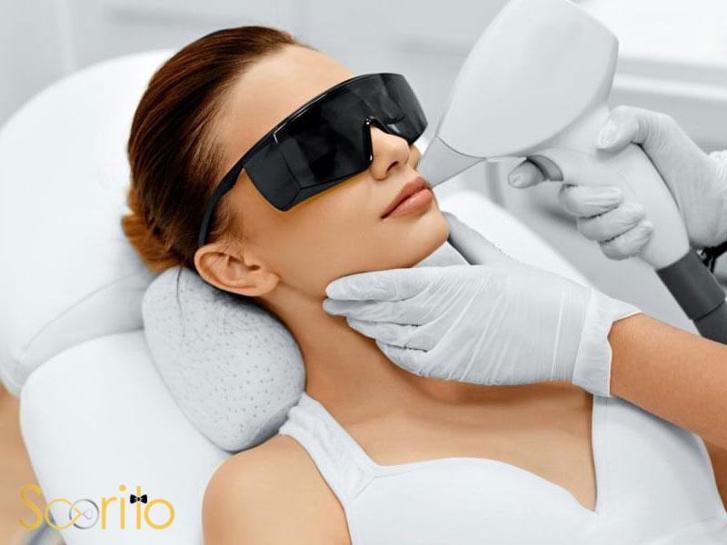 بهترین مرکز لیزر موهای زائد در غرب تهران و خانم در حال لیزر صورت