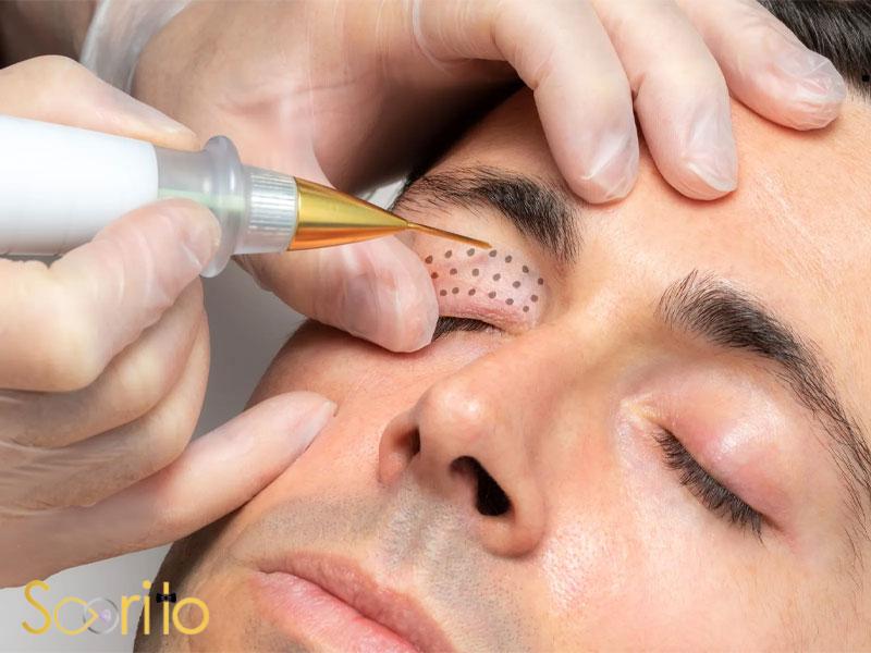 بهترین کلینیک پلاسماجت و پلاسما تراپی در غرب تهران