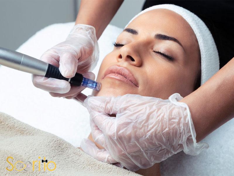 بهترین مرکز میکرونیدلینگ و مزوتراپی در غرب تهران