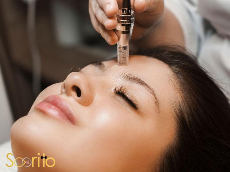 بهترین مرکز میکرونیدلینگ و مزوتراپی در شمال تهران