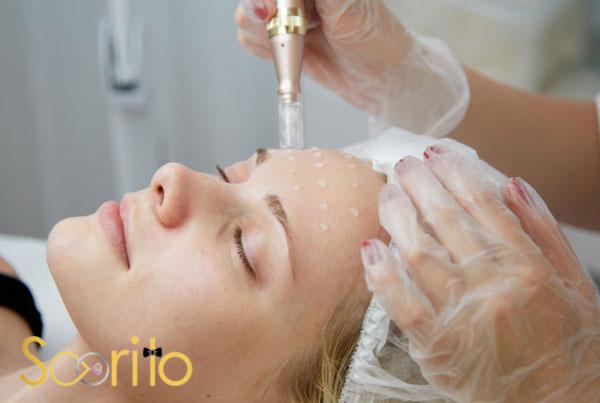 بهترین مرکز میکرونیدلینگ و مزوتراپی در شمال تهران