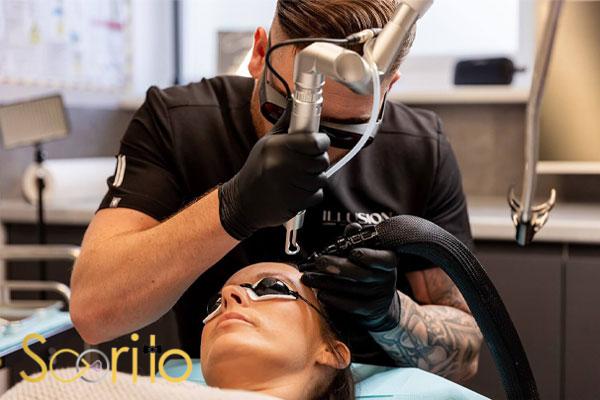 بهترین کلینیک لیزر رفع تاتو در شمال تهران