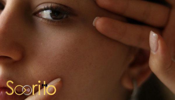 بهترین مرکز درمان لک و جوش صورت در شمال تهران