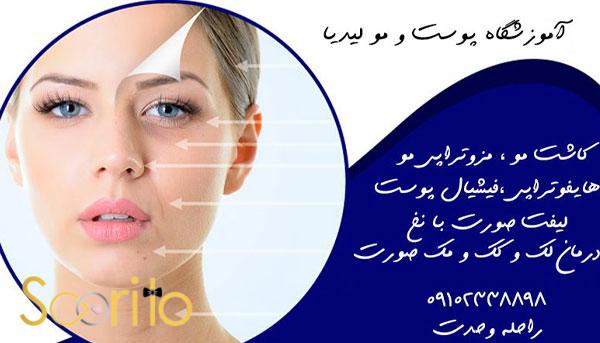بهترین مرکز درمان لک و جوش صورت در شمال تهران