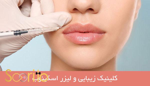 بهترین مرکز درمان لک و جوش صورت در شمال تهران