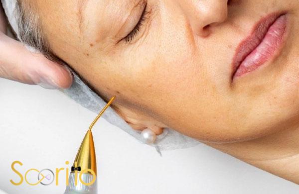 بهترین کلینیک پلاسماجت و پلاسما تراپی در شمال تهران