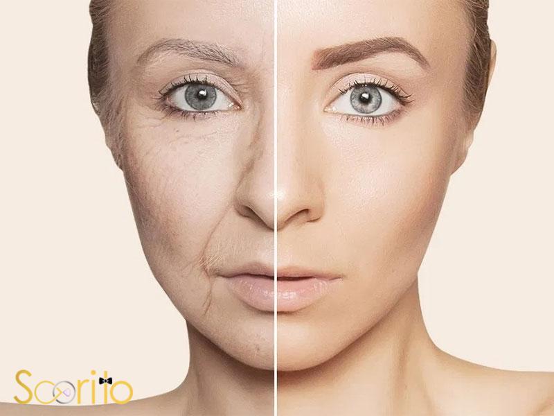 بهترین کلینیک درمان چروک و افتادگی پوست در شمال تهران