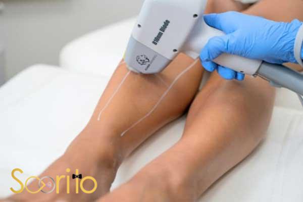 بهترین مرکز لیزر موهای زائد در تهران