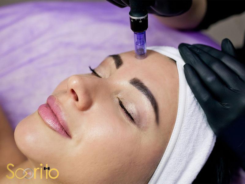 بهترین مرکز میکرونیدلینگ و مزوتراپی در تهران