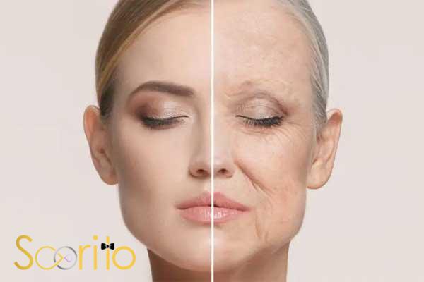 بهترین کلینیک درمان چروک و افتادگی پوست در تهران